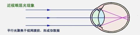 近视眼福音：用户无需戴眼镜就能看清显示屏
