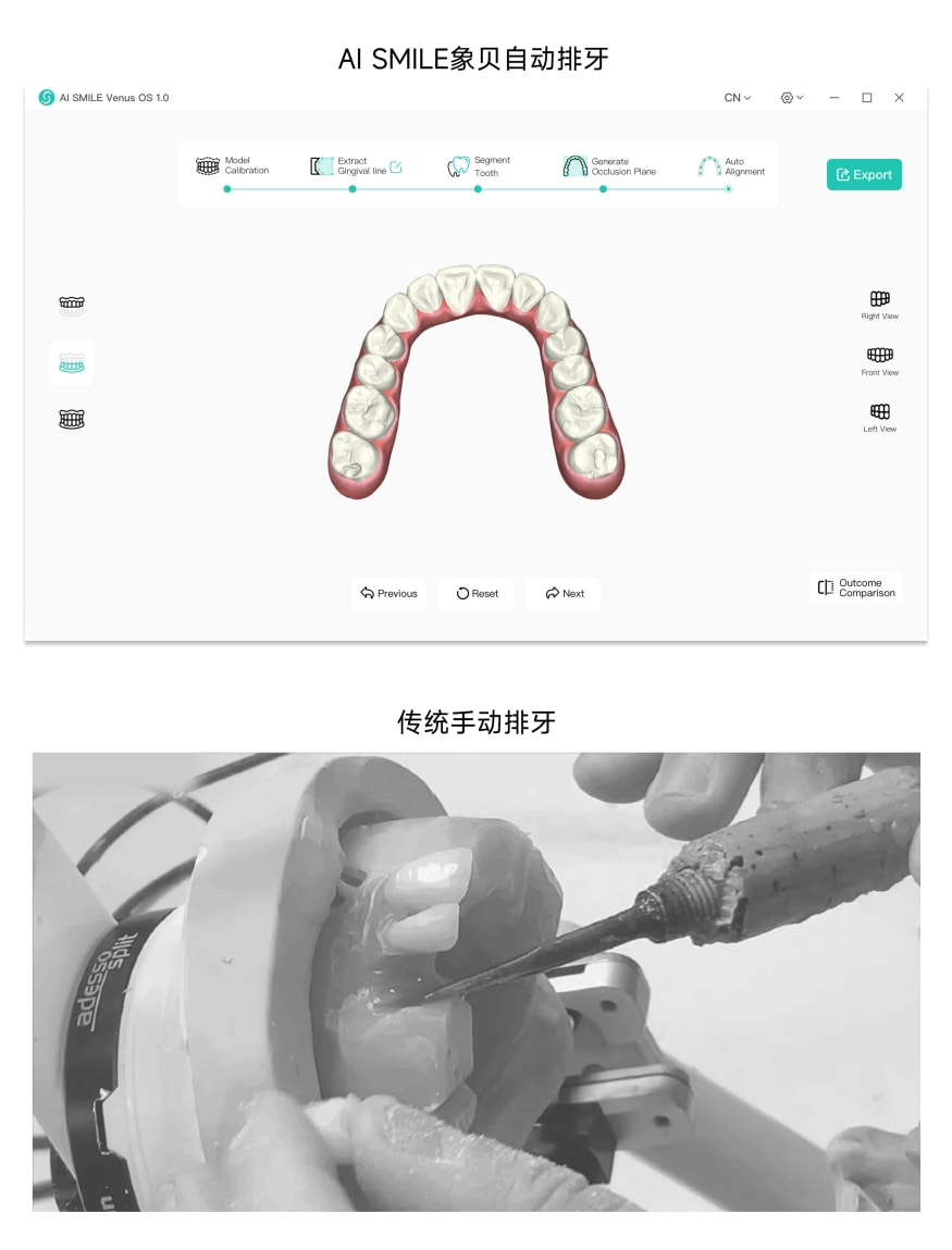 独角兽地位尽显！象贝AI正畸排牙系统Venus1.0发布 开辟数字化牙科新纪元